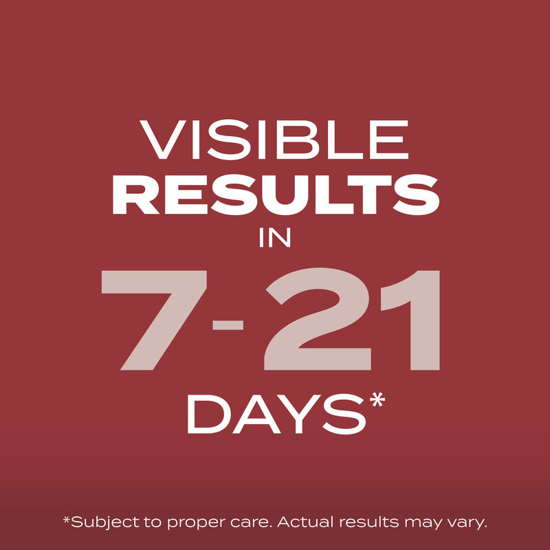 Scotts&reg; Turf Builder&reg; Grass Seed Sunny Mix image number null